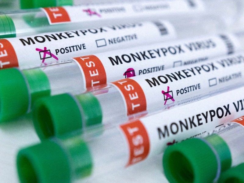 México registra 147 casos de viruela del mono; CDMX, con el mayor número