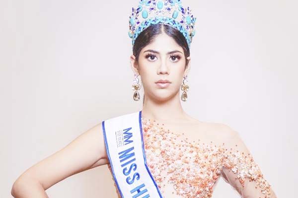 Miss Hidalgo denuncia a expareja por agresiones