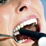 Mitos y realidades sobre las caries, ¿Cómo mantener una buena higiene bucal?