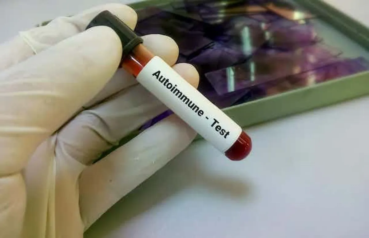 Enfermedades autoinmunes: cuando el enemigo es uno mismo