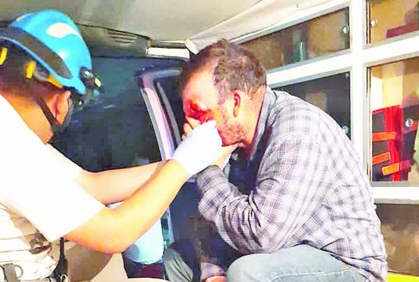 Menores le dan botellazo en cabeza