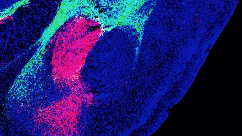 Encuentran la molécula que da origen al miedo en el cerebro