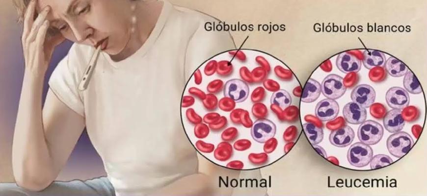 ¿Por qué se enferma la sangre de cáncer? Esto dicen especialistas