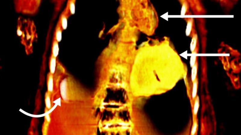 LA MOMIA QUE FUE ENTERRADA CON UN «CORAZÓN DE ORO» HACE 2.300 AÑOS EN EGIPTO