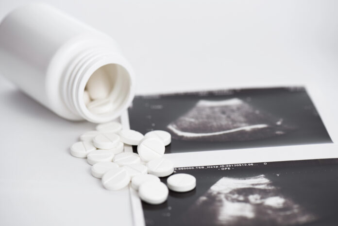ABORTO FORZADO EN MÉXICO OCURRE EN UN CONTEXTO DE VIOLENCIA E IMPUNIDAD, SEÑALA LA UNNA