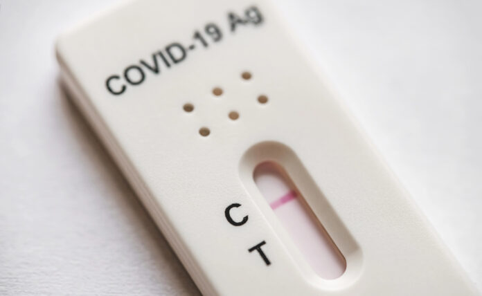 DESARROLLAN EN MÉXICO MÉTODO RÁPIDO Y PRECISO PARA DETECTAR EL VIRUS SARS-COV-2