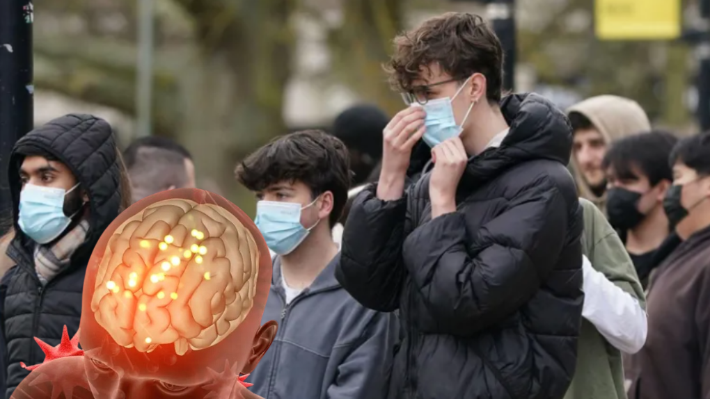 ALERTA POR EPIDEMIA DE MENINGITIS EN INGLATERRA; ¿QUÉ ES Y CÓMO AFECTA A LA COMUNIDAD UNIVERSITARIA?